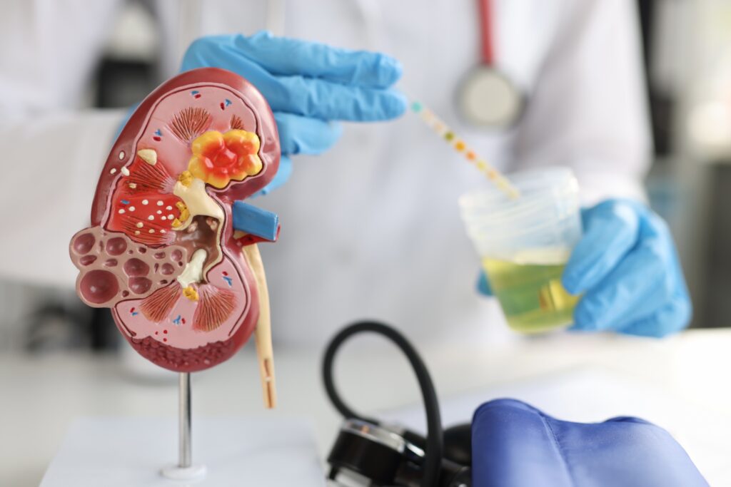 2 Enfermedad renal crónica terapia combinada