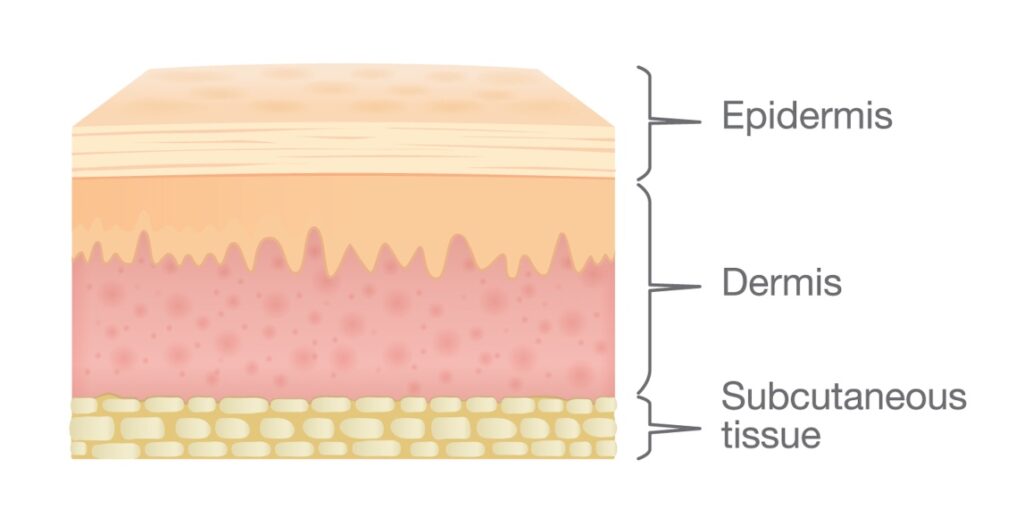 3 Día Mundial Dermatitis Atópica 2025
