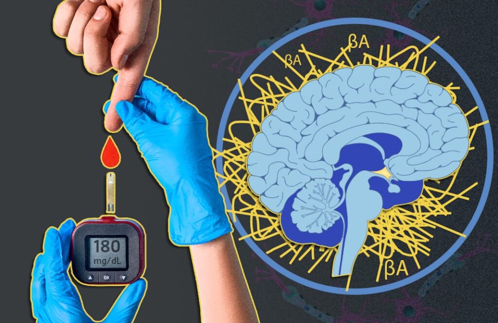 3 Diabetes enfermedad de Alzheimer
