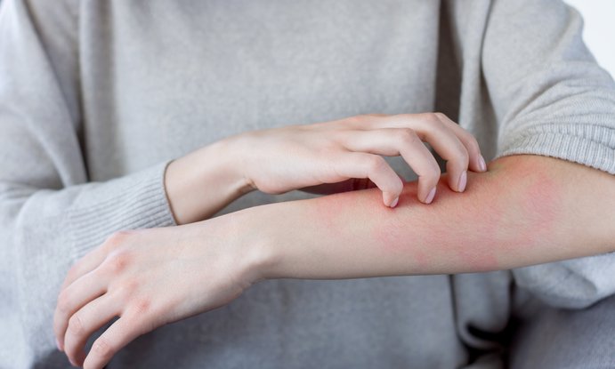 5 Día Mundial Dermatitis Atópica 2025