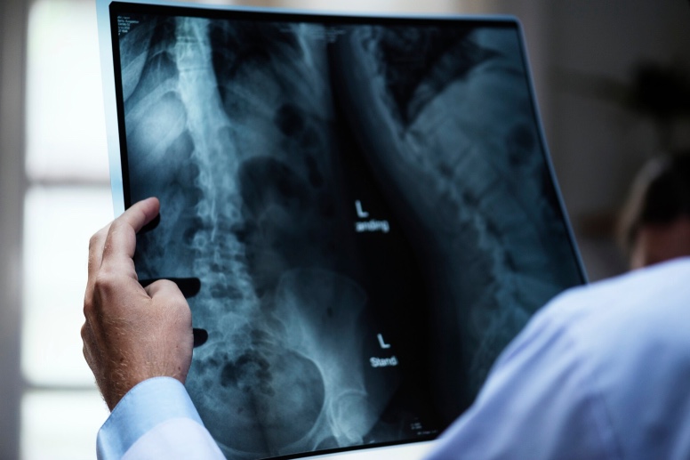 1 Piel osteoporosis