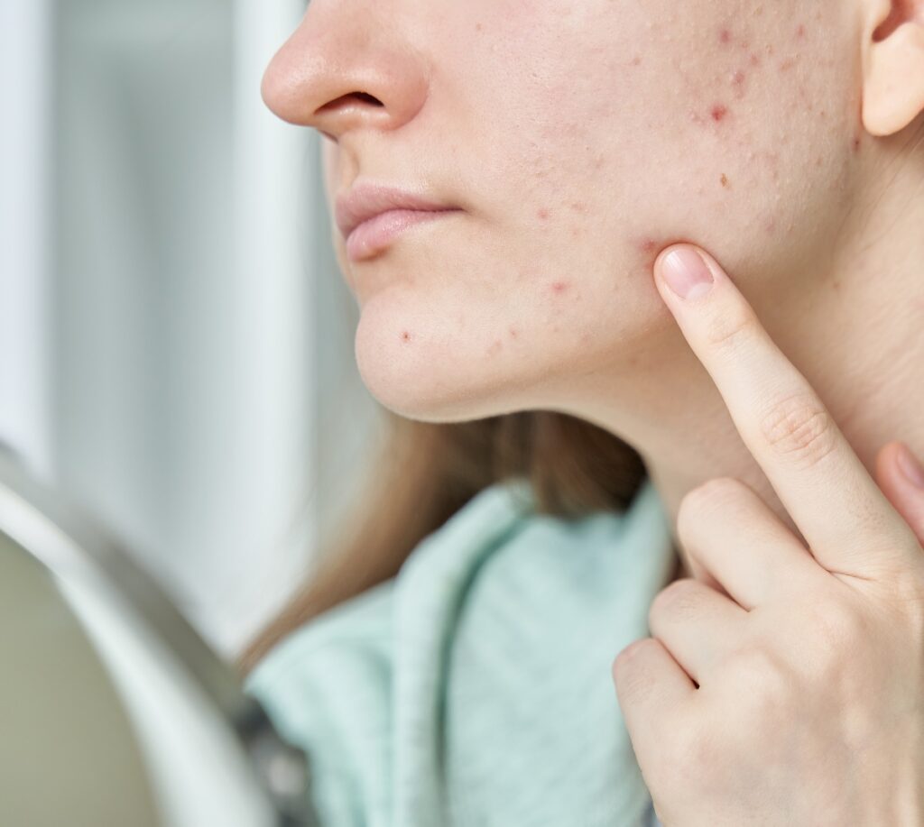 5 Microbiota piel