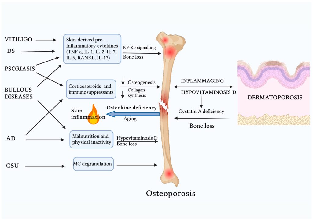 7 Piel osteoporosis