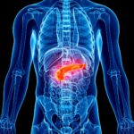 0 Teplizumab diabetes tipo 1