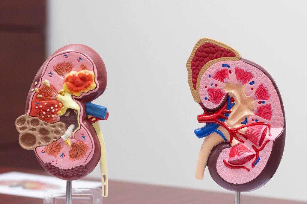 1 Día Mundial Diabetes 2025 enfermedad renal