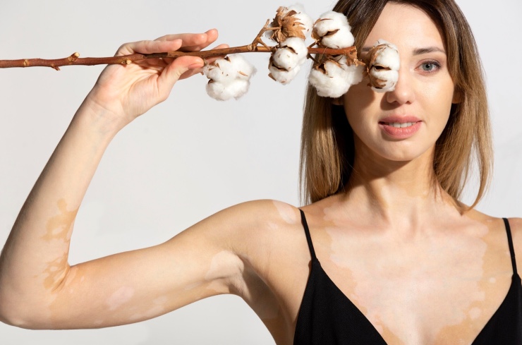 1 Genética dermatología