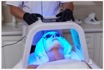 2 Fototerapia psoriasis