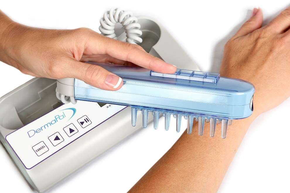 5 Psoriasis fototerapia