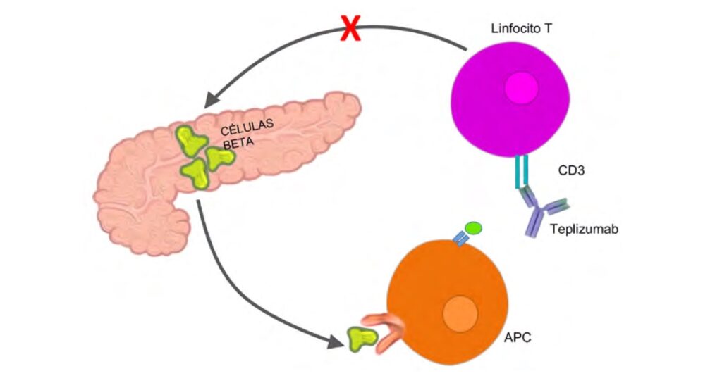 5 Teplizumab diabetes tipo 1