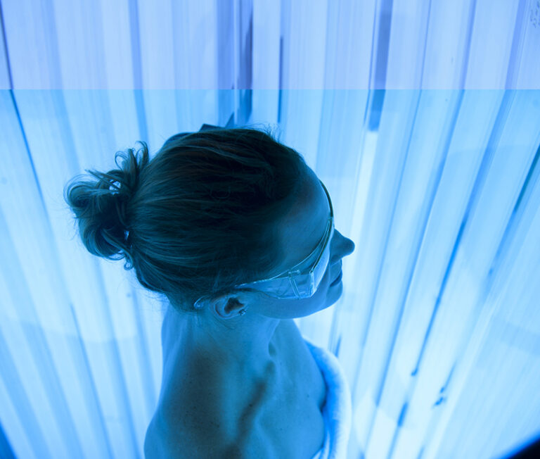 0-Fototerapia-psoriasis