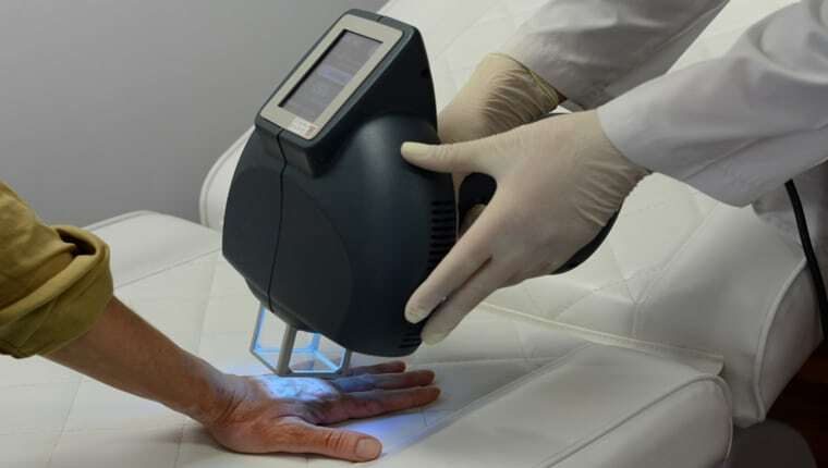 7 Fototerapia psoriasis