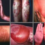 000-diabetes-piel-guia
