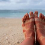 0 Cáncer piel cambio climático