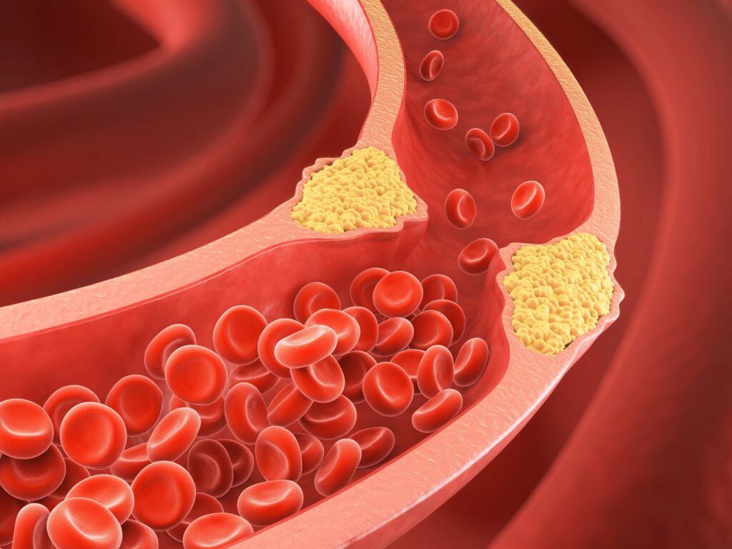 2 Semaglutida control peso