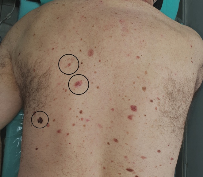3 Dermatología Argentina 3 2025