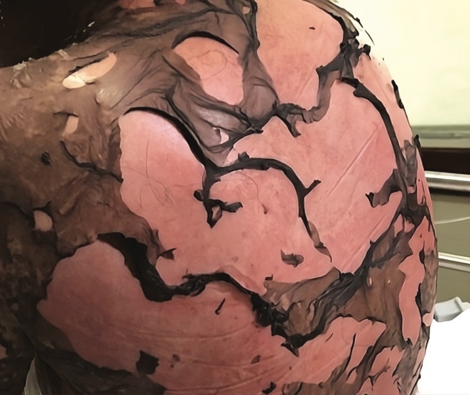 5 Dermatología Argentina 3 2025