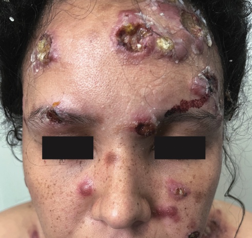 7 Dermatología Argentina 3 2025