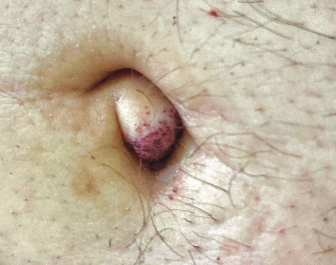 9 Dermatología Argentina 3 2025