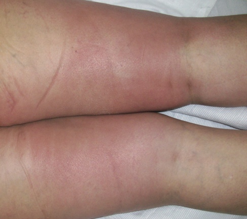 10 Dermatología Argentina 3 2025