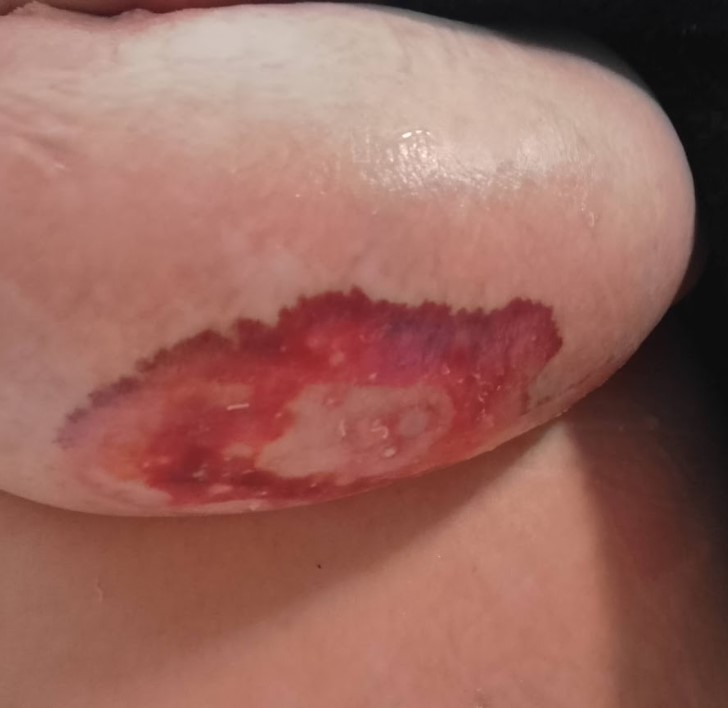 6 Dermatología Argentina 3 2025