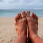 0 Cáncer piel cambio climático