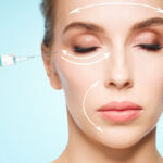 0 ácido hialurónico arrugas CHFI18