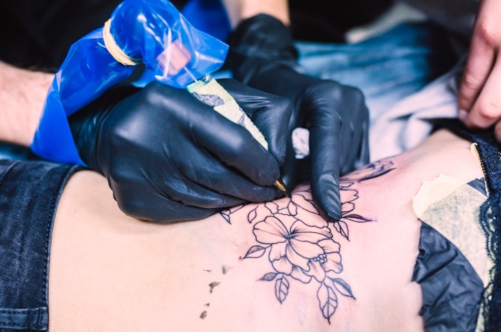 1 Tatuajes riesgo melanoma