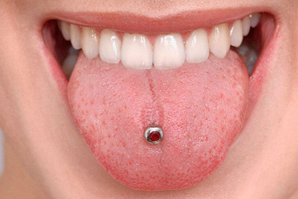 2 Riesgos piercing lengua
