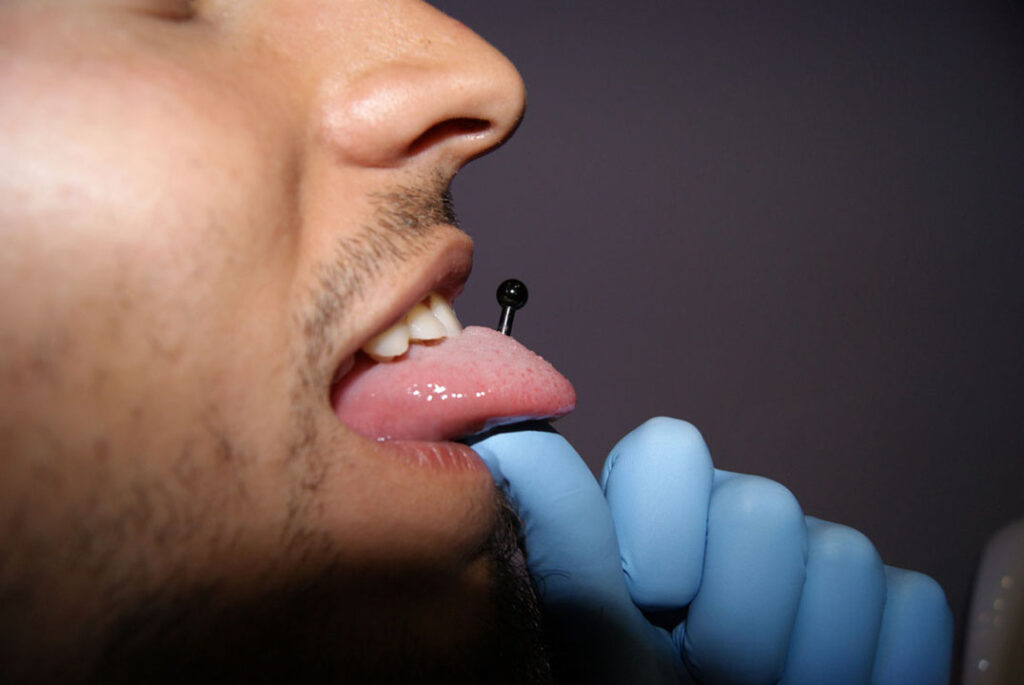 4 Riesgos piercing lengua