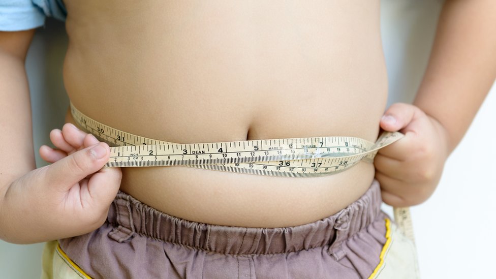 5 Piel niños obesidad