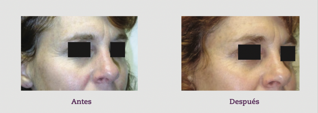 Captura de Pantalla 2025 12 04 a las 11.10.21