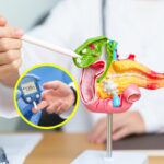 0 Diabetes tipo 1 teplizumab.png