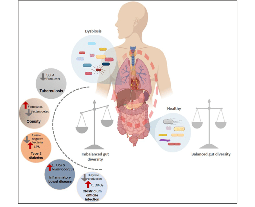 1 Microbiota intestinal y diabetes