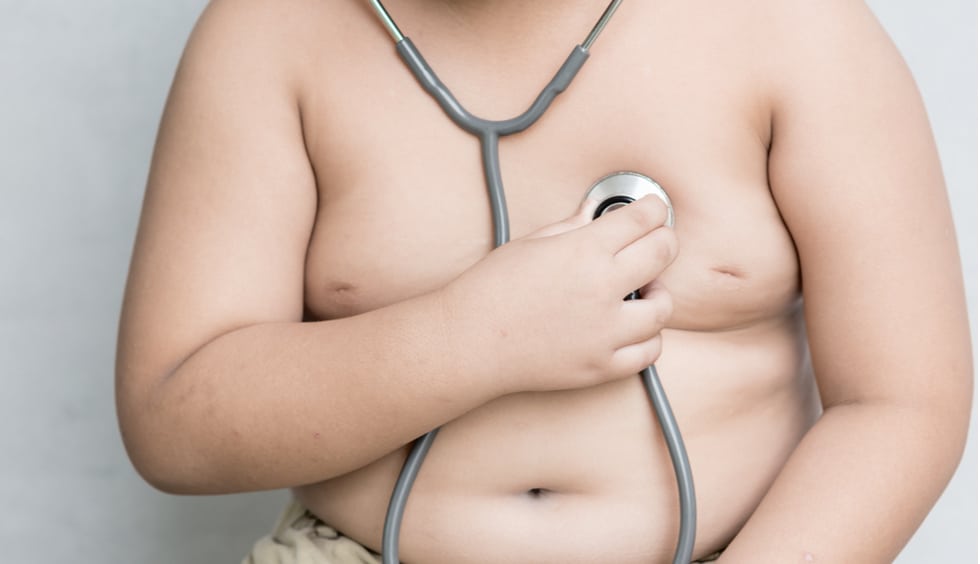 2 Obesidad infantil y fenotipos