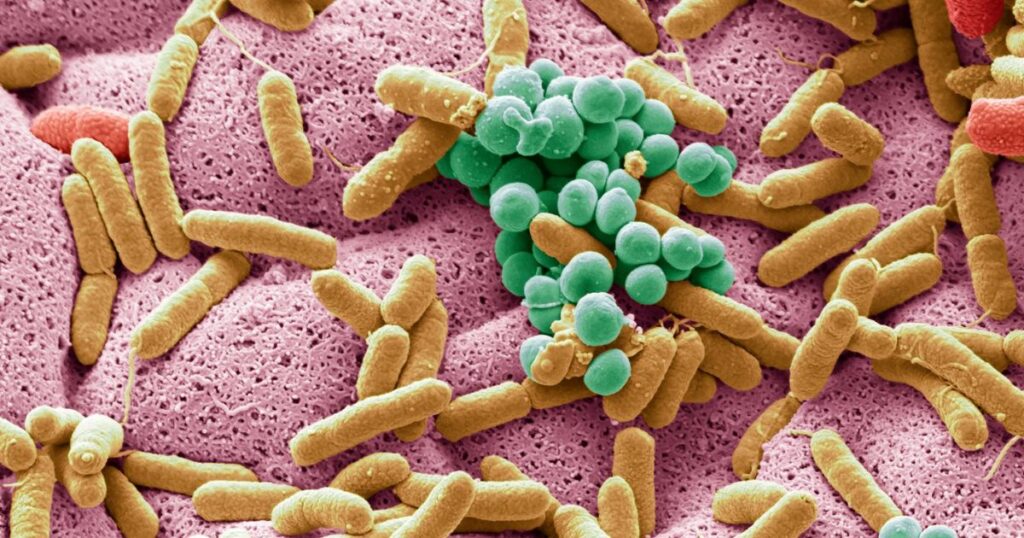 5 Microbiota intestinal y diabetes