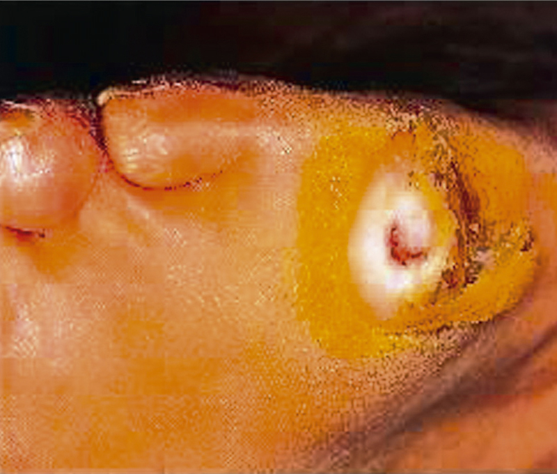 Diabetología-3-abordaje integral-10
