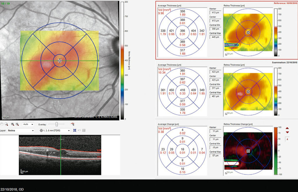 Diabetología-3-abordaje integral-8