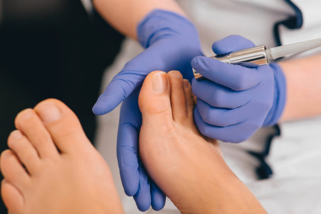 00 Láser enfermedades uñas