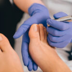 00 Láser enfermedades uñas