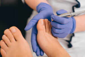 00 Láser enfermedades uñas