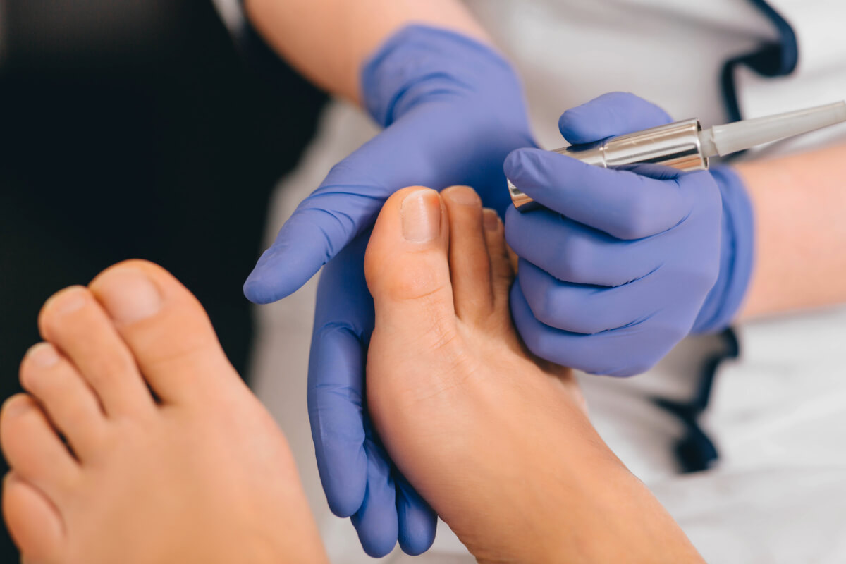 00 Láser enfermedades uñas