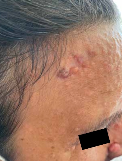 12 Dermatología Argentina 1 2026