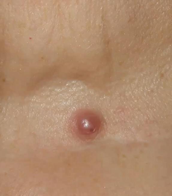 4 Dermatología Argentina 1 2026