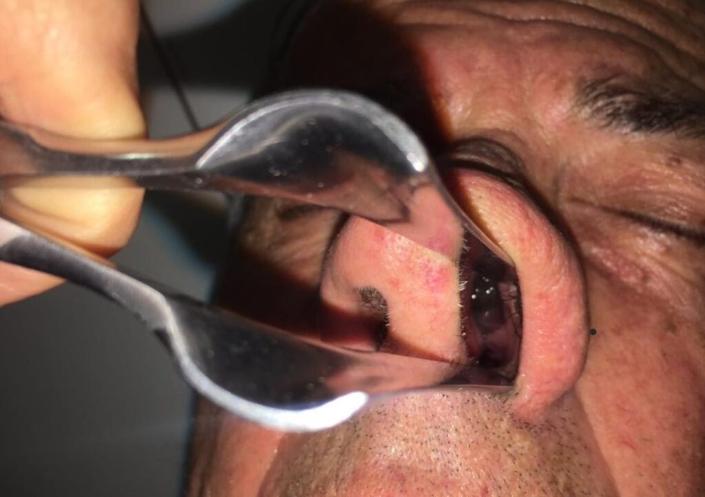 13 Dermatología Argentina 1 2026