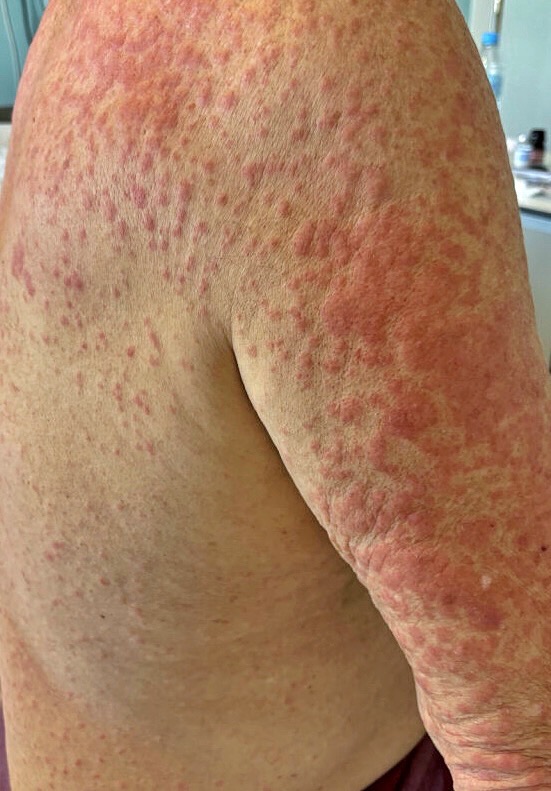 3 Dermatología Argentina 1 2026