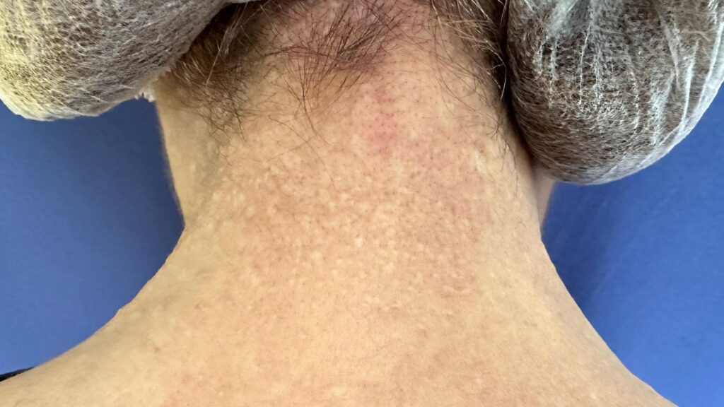 16 Dermatología Argentina 1 2026