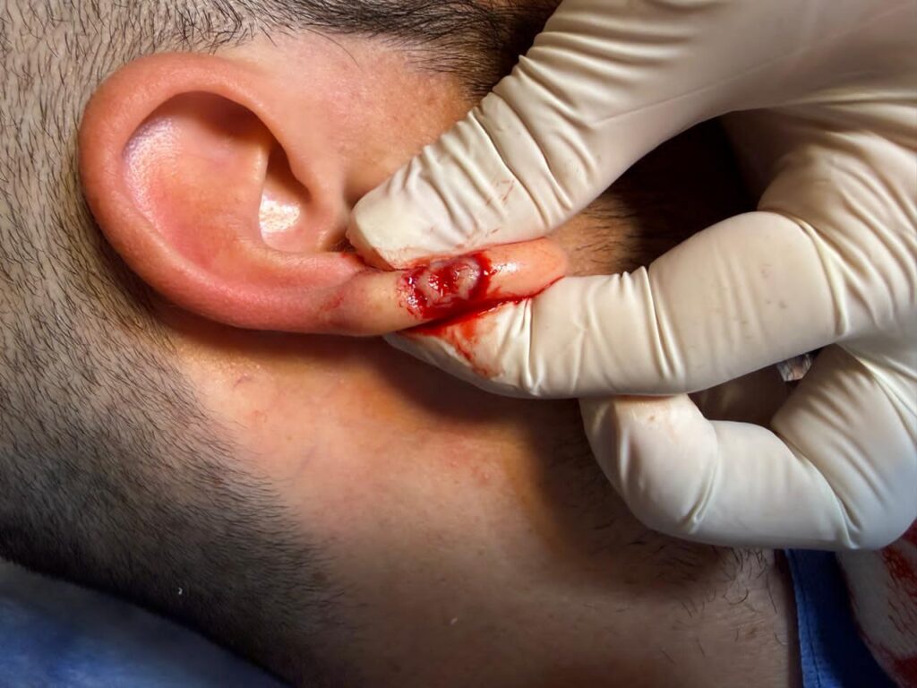 1 Dermatología Argentina 1 2026