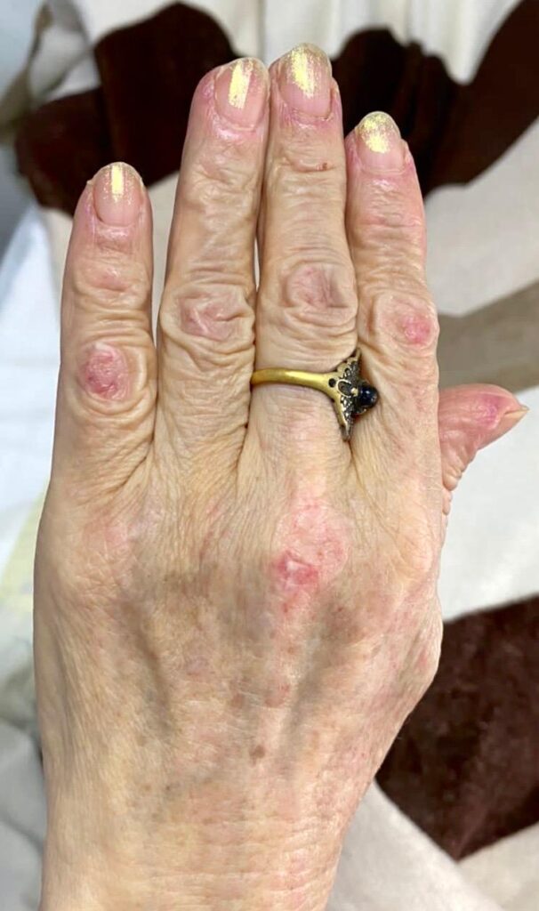 14 Dermatología Argentina 1 2026