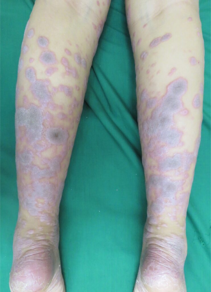 8 Dermatología Argentina 1 2026