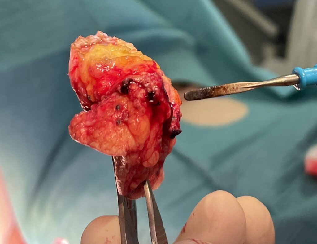 15 Dermatología Argentina 1 2026